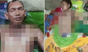 Diduga Cemburu, Oknum Sekdes Bakar Selingkuhan di Padangsidimpuan ;https://sekilassumut.biz.id/